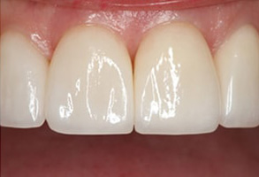 dental images 10016